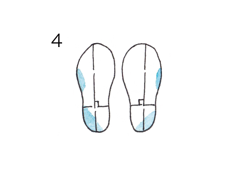靴底を見れば足トラブルの原因がわかる！ 巻き爪・タコ・外反母趾になるのはなぜ？