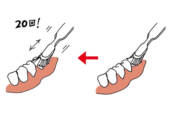 正しいマウスケアで歯周病を防ぐ！ 歯科医直伝の歯磨き方法やおすすめアイテムを紹介