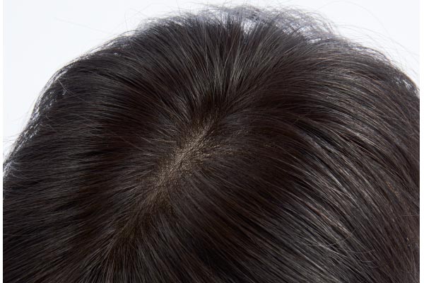 ウィッグの選び方や最新情報｜大人世代の髪悩みの解決法を専門家がアドバイス