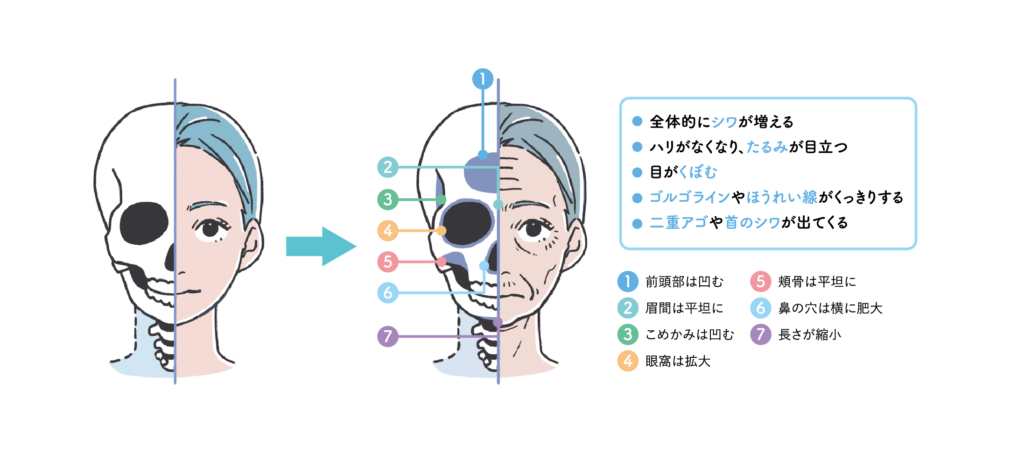 骨密度と顔の変化